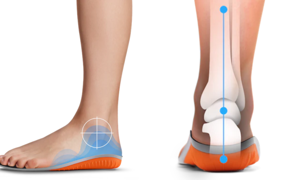 protalus insoles, arch support